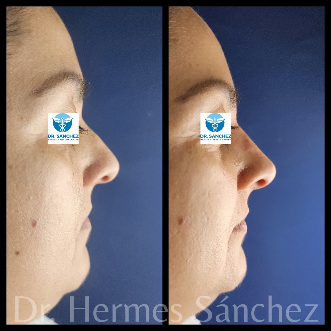 Galería - Transformación 1